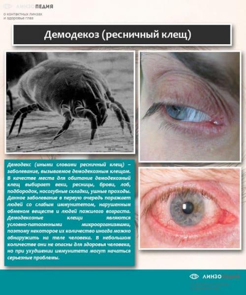 Покраснение под глазами и шелушение. У взрослых