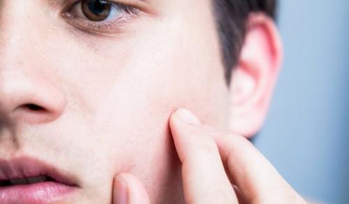 Как избавиться от зуда и покраснения на коже. Проявления