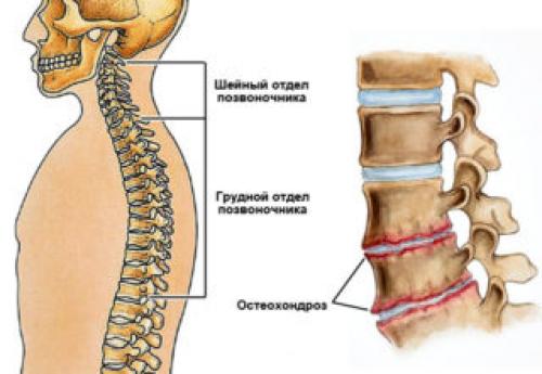 Болит справа вверху над грудью. Боль в левой и в правой стороне грудины вверху