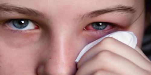 Аллергия на полынь лечение. Симптомы заболевания