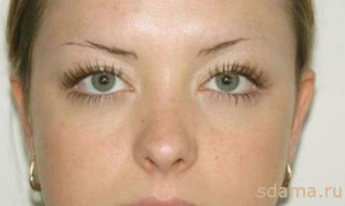 Не растут брови в одном месте. Средства для восстановления роста бровей