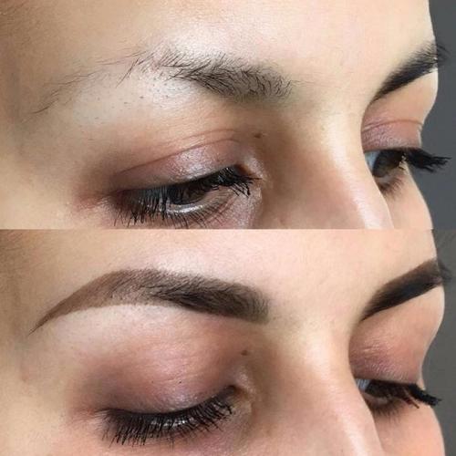 Плохо растут брови. Восстановление бровей