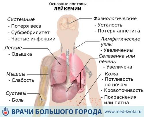 Появляются синяки на руках и ногах без причины. Почему появляются синяки 01 Появляются синяки на руках и ногах без причины. Почему появляются синяки 01