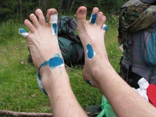 Как удалить мозоль на пальце ноги. Обзор средств и методов для удаления мозолей на пальцах ног в домашних условиях