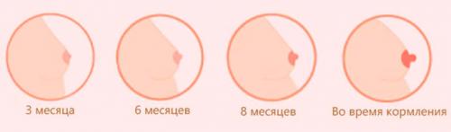 Изменение цвета ареолы соска. Особенности изменения окраски сосков после наступления зачатия