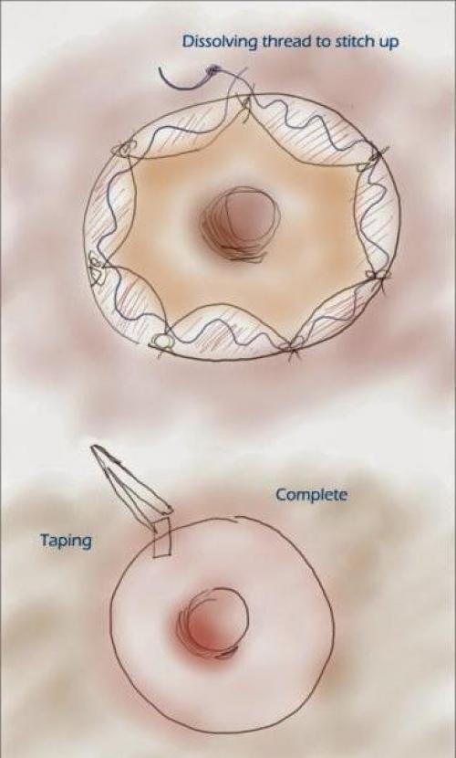 Сухие соски. Почему шелушатся соски? Как с этим бороться? 06