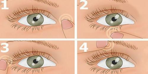 Как убрать мешки под глазами навсегда. Как быстро убрать или замаскировать мешки под глазами