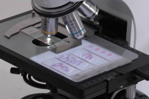 Нити мицелия в мазке, как лечить. Что означает мицелий в мазке у мужчин?