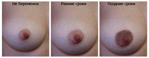 Изменение цвета ареолы соска. Особенности изменения окраски сосков после наступления зачатия