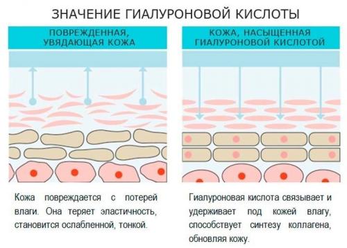 Как правильно пить коллаген и гиалуроновую кислоту. В чем разница между коллагеном и гиалуроновой кислотой