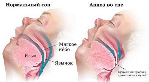 Дыхательная гимнастика для снижения веса. Дыхательная гимнастика для похудения живота 01
