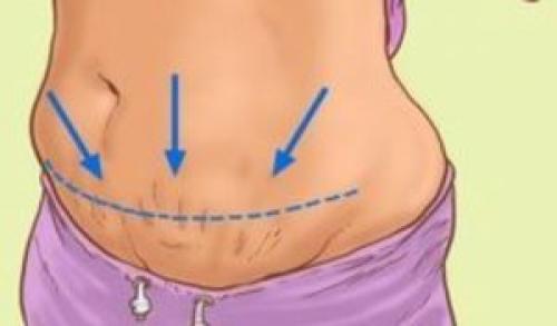 Яблочный уксус для похудения растирания. Способы применения яблочного уксуса для похудения