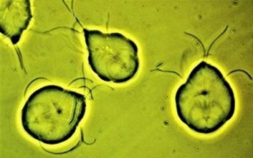 Диета при лямблиозе у взрослых меню рецепты. Как питаться при лямблиозе 05 Диета при лямблиозе у взрослых меню рецепты. Как питаться при лямблиозе 05