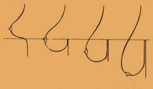 Как подтянуть грудь. Основные причины отвисания бюста