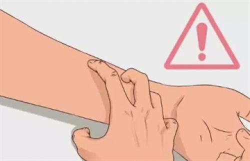 Можно ли есть бананы при Манту. Прививка Манту: что можно и что нельзя делать?