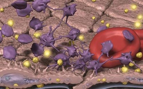 Питание при пониженных тромбоцитах. Какие продукты повышают тромбоциты в крови и снижают их уровень?