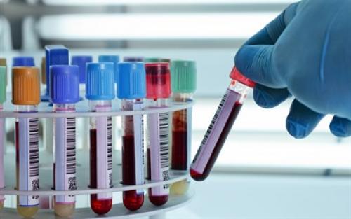 Питание при пониженных тромбоцитах. Какие продукты повышают тромбоциты в крови и снижают их уровень?