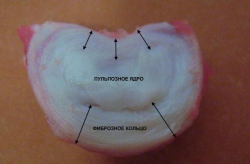 Невролог или нейрохирург кого выбрать при грыже в позвоночнике. Когда необходимо обратиться за помощью?