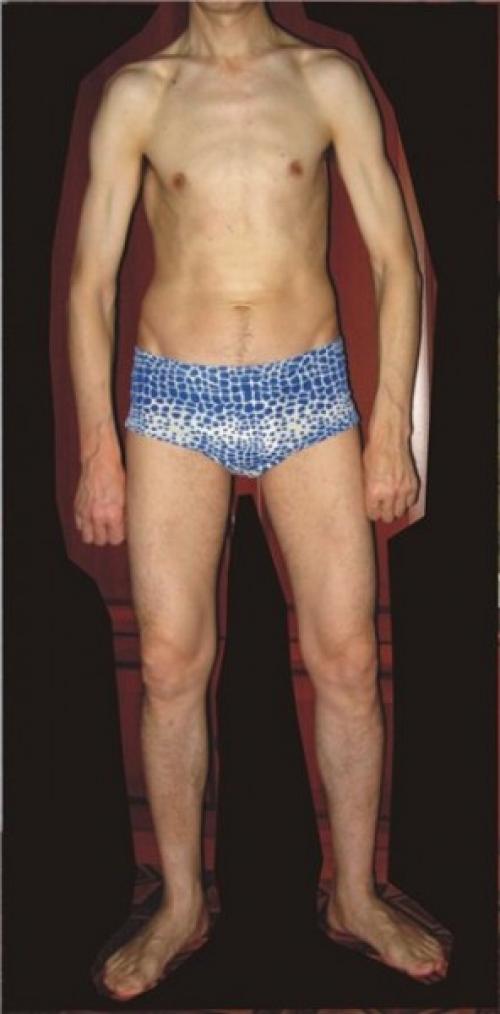 Как сделать бедра тоньше парню. 10 Недостатков мужского тела, которые ненавидят женщины