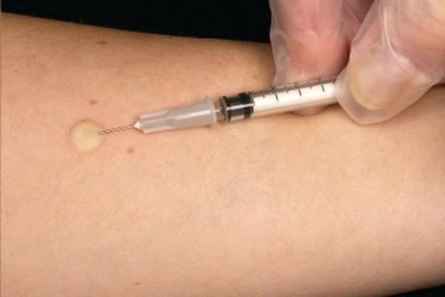 Прививка Манту, что нельзя кушать детям комаровский. Когда делают