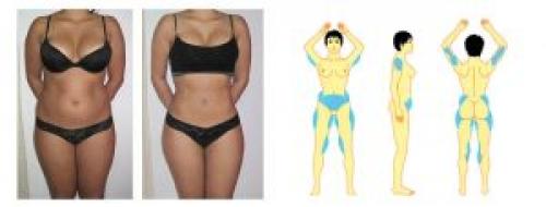 Как убрать живот после 40 лет мужчине. Как живот убрать мужчине