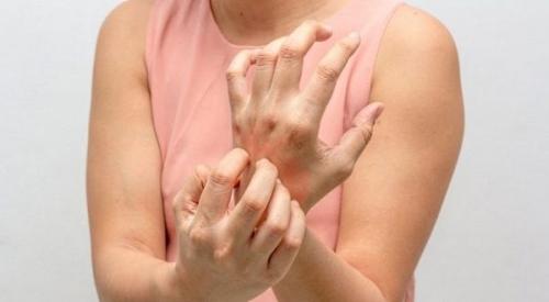 Стрептодермия у детей, взрослых: фото, виды, лечение