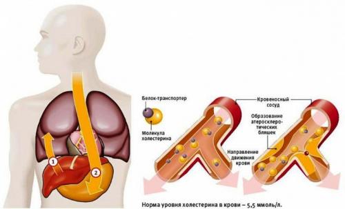 Гиполипидемическая диета при атеросклерозе. Особенности стандартной гиполипидемической диеты