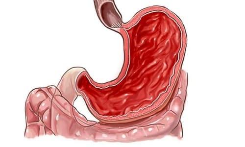 Виктоза и алкоголь. Виктоза – инструкция по применению, цена, отзывы, аналоги