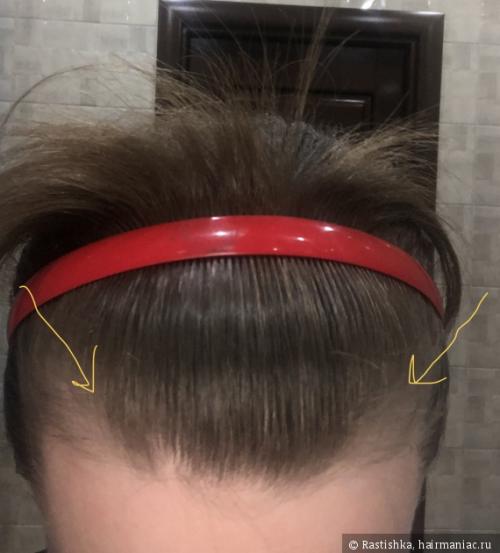 Средства для роста волос. ТОП-5 стимулирующих средств для роста волос