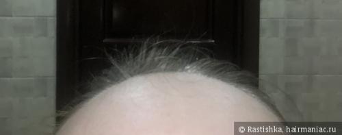 Средства для роста волос. ТОП-5 стимулирующих средств для роста волос