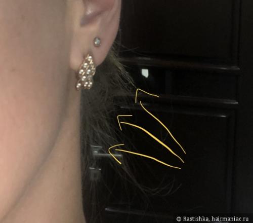 Средства для роста волос. ТОП-5 стимулирующих средств для роста волос