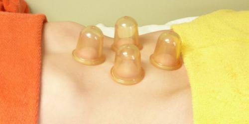 Можно ли ставить банки на живот для похудения. Массаж банками для похудения — отзывы