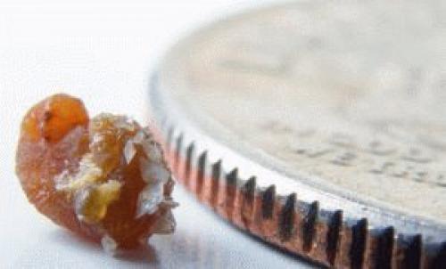 Кальция оксалат моногидрат. Кальцийсодержащие