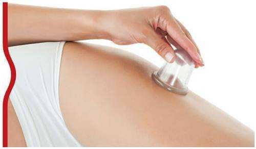 Можно ли ставить банки на живот для похудения. Массаж банками для похудения — отзывы