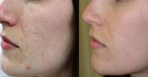 Лактофильтрум помогает ли похудеть. Лактофильтрум: похудение или отравление? 01 Лактофильтрум помогает ли похудеть. Лактофильтрум: похудение или отравление? 01