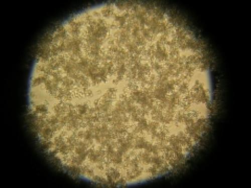 Фосфатурия у детей диета. Лечебная диета при фосфатных камнях в почках: правильное питание для растворения фосфатов 04