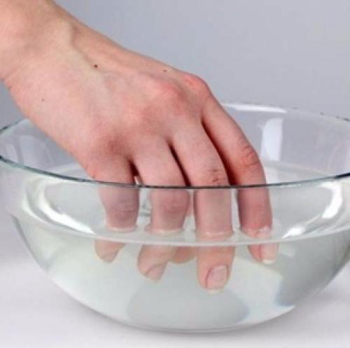 Шишка на пальце руки от неправильного держания ручки. Как быстро убрать мозоль от шариковой ручки