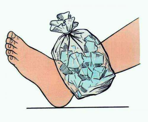 Сколько заживают связки. Заключение