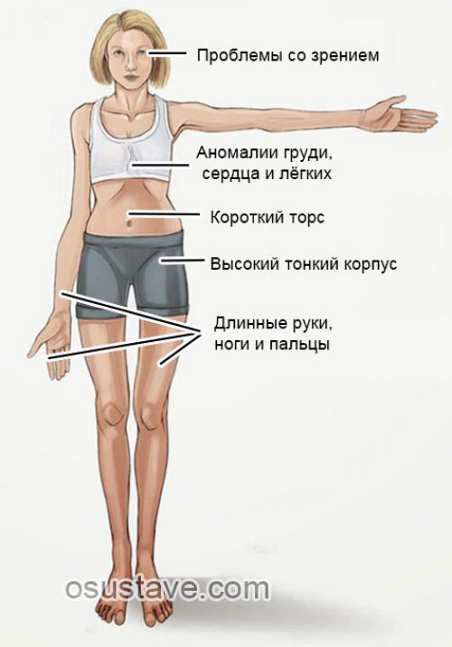Частичный разрыв заднего рога медиального мениска лечение. Причины и механизмы разрыва мениска