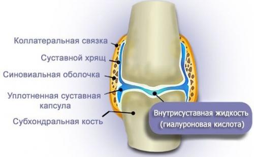 Инъекция гиалуроновой кислоты в суставы препараты. Фармакодинамика и фармакокинетика