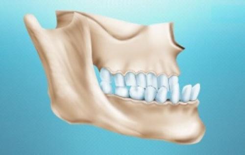 Болит и щелкает челюсть. Щелкает челюсть при открытии рта: этиология и лечение