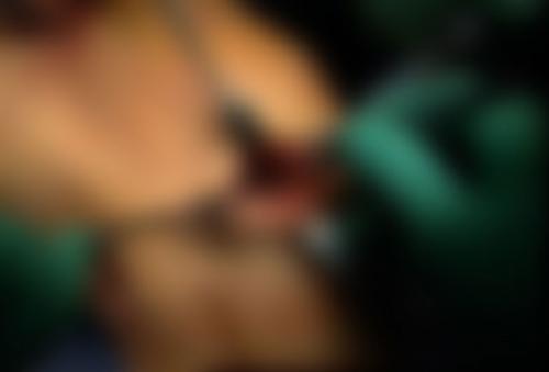 Нужно ли удалять мениск если он поврежден. Техника полного и частичного удаления мениска, эффективность операции, осложнения