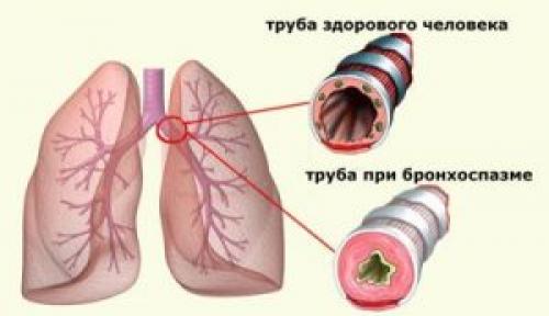 Настойка с анальгином. Настойка из Анальгина для суставов