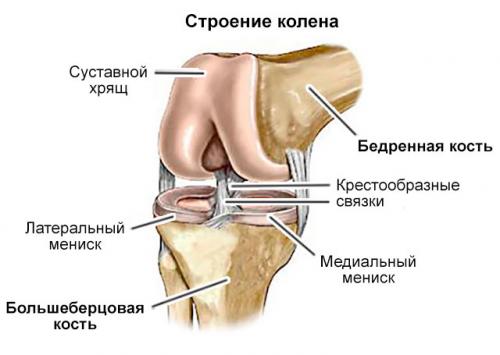 Дегенеративные изменения заднего рога медиального мениска. Дегенеративные изменения менисков: заднего рога, медиального, 4 степени патологии