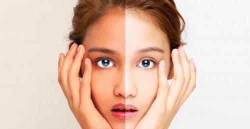 Как развести димексид для лица. ДИМЕКСИД В МЕДИЦИНЕ И КОСМЕТОЛОГИИ