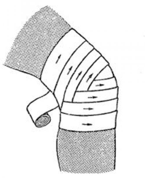 Повязка на локоть схема