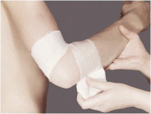 Сходящаяся и расходящаяся повязка. Сходящаяся и расходящаяся черепашья повязка на локоть и колено