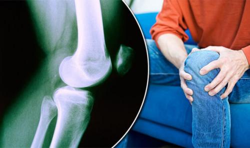 Рецепт от суставов с анальгином. Бабушкина растирка: рецепт для суставов