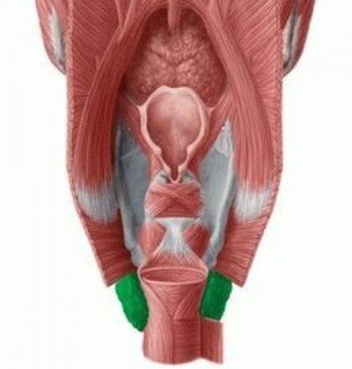 Сводит ногу в бедре, что делать. Сводит мышцы ног в ляшках –, что делать при судорогах бедра