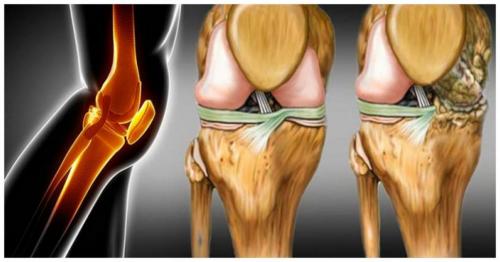 Таблетки для наращивания хрящей в суставах. Хрящевая ткань позвоночника 02